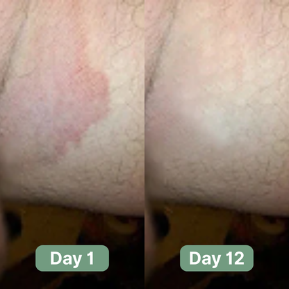 Velmori Antifungal Soap